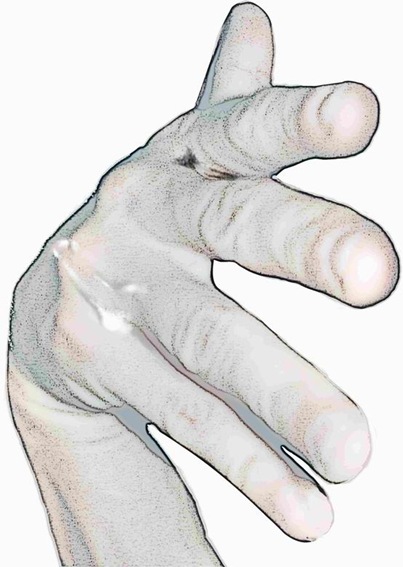 sexfingers