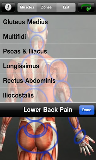 【免費醫療App】Muscle Trigger Point Anatomy-APP點子