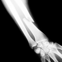 An Overview of Musculoskeletal Trauma - Treatment & Care