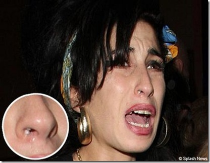 Amy+Winehouse+With+The+Suspicious+White+Powder+In+Her+Nostril%5B3%5D