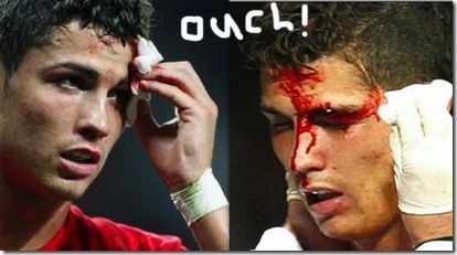    - Page 2 Cristiano+Ronaldo+hurts+face%5B2%5D