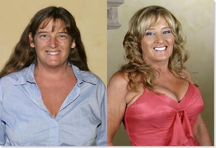 plastic-surgery