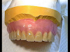 Libro Protesis Fija En Dientes Anteriores