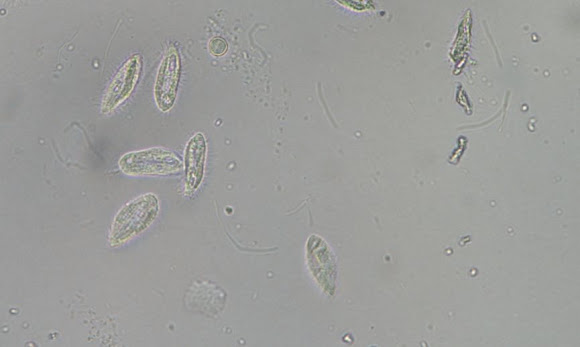 Spotting Image 1