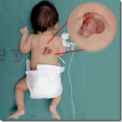 babypdg6