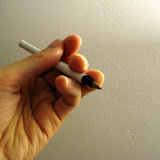 My hand has healed, but the index finger and ring finger are rotated now, making it difficult for me to write