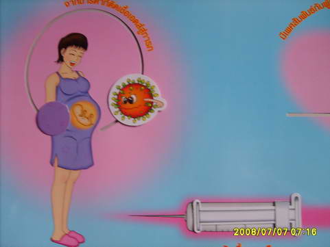 [photo mblog bonkalasin]