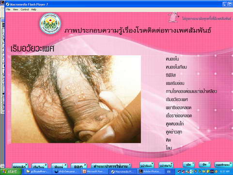 [photo mblog bonkalasin]