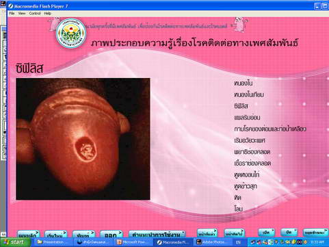 [photo mblog bonkalasin]