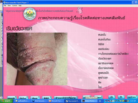[photo mblog bonkalasin]