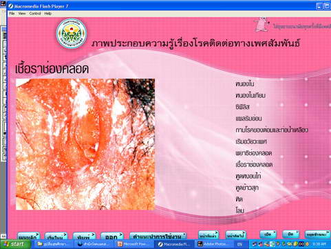 [photo mblog bonkalasin]