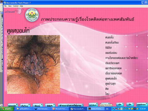 [photo mblog bonkalasin]