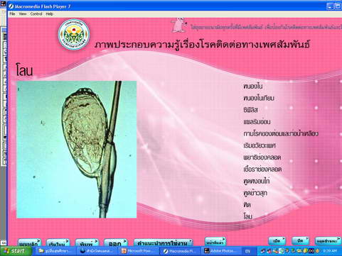 [photo mblog bonkalasin]