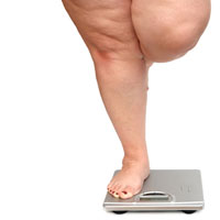 What is Bariatrics? Obesity: A Growing Problem in Health Care