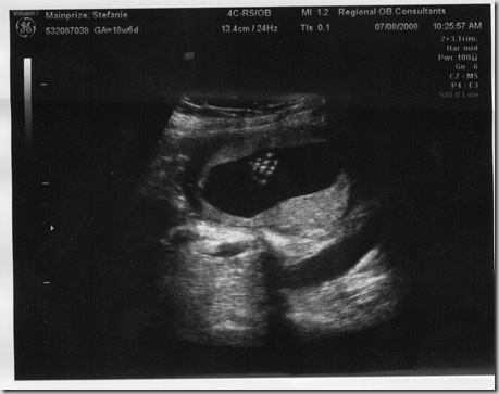 baby hand