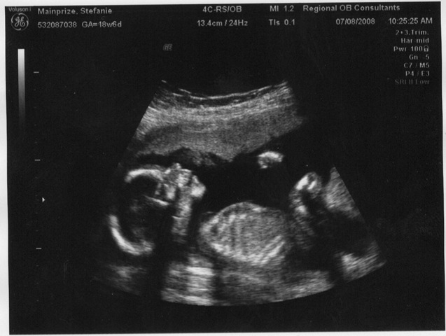 [baby profile[5].jpg]
