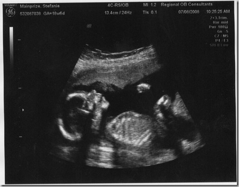 baby profile