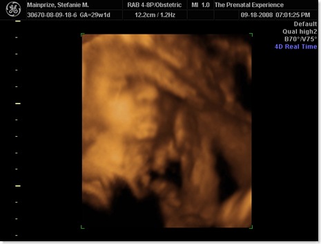 emilyultrasound 033