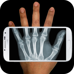 Xray Scanner Prank Hacks and cheats