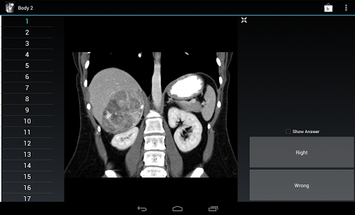 How to mod Radiology Flashcards: Body 2 patch 1.4 apk for laptop