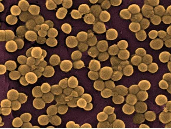 [Staphylococcusaureus15.jpg]