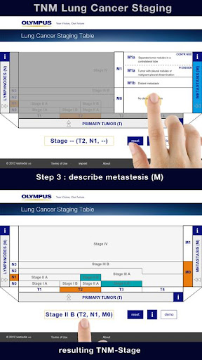 Lung Cancer Staging Table