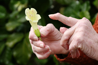 hands with arthiritis