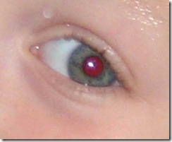 red_eye_before470_470x386