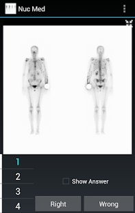 How to download Radiology Flashcards: Nuc Med 1.4 apk for bluestacks