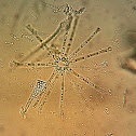 Asterionella sp.