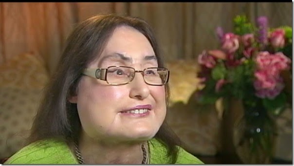 connie culp fotos transplante cara (11)