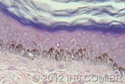 [diferenciacao-celulas-pele%2520in6.com.br%255B5%255D.jpg]