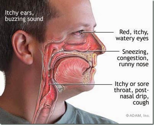 symptoms-of-hay-fever[1]