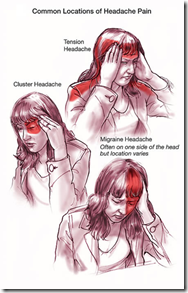Migraine-Headache
