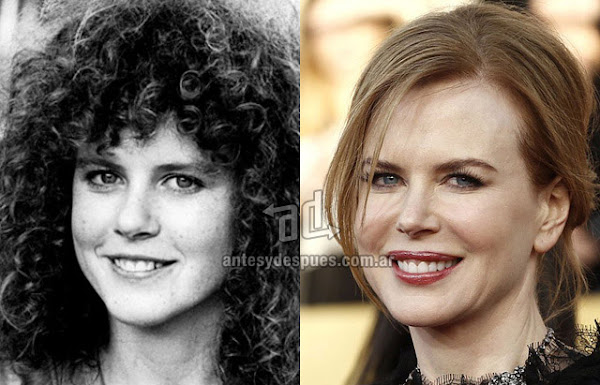 La nueva nariz operada de Nicole Kidman