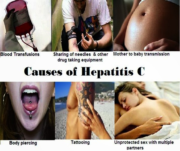 Causes of hep C(4)