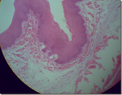 Stratified squamous epithelium magnified view microscopy