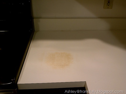 Ashley's potholder burn Ashley's potholder burn