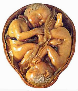 Gemelli in separate membrane (cera anatomica Museo della Specola, Firenze) Gemelli in separate membrane (cera anatomica Museo della Specola, Firenze)