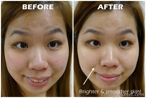 [Ginvera%2520Marvel%2520White%2520Zero%2520Blackheads%2520Marvel%2520Gel%2520Review%25201%255B3%255D.jpg.webp]