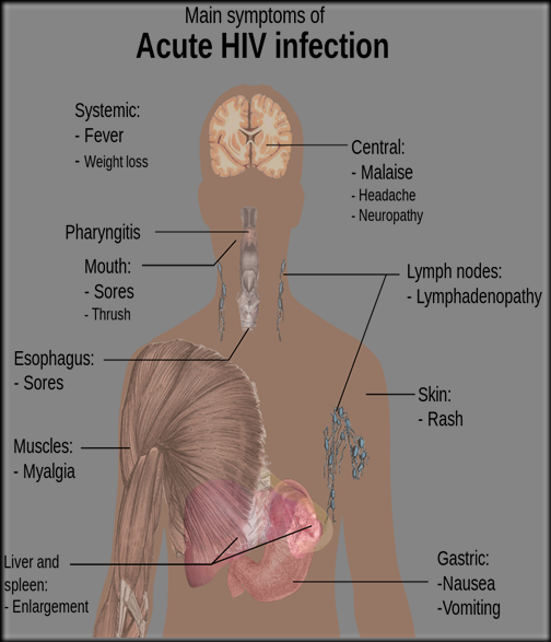 1024px-Symptoms_of_acute_HIV_infection.svg