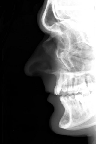 Halloween-iphone-wallpaper-skull-life