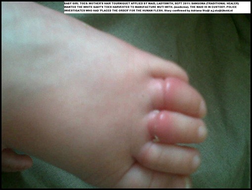 BABY TOES HARVESTED BY MAIDS FOR WITCHDOCTORS SEPT 2011 LADYSMITH