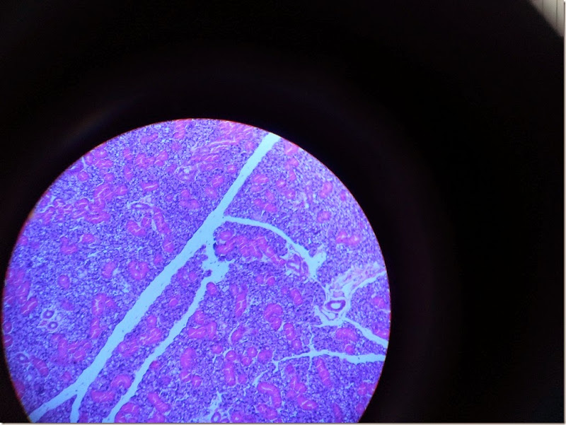 mixed_gland_Histology_slide