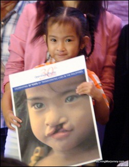 Operation Smile Beneficiary 