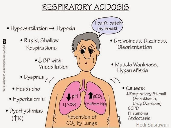 15 Penyebab Asidosis Respiratorik