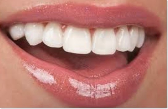 Want Whiter Teeth 5 Remedies to Restore Your Smile