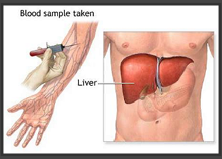 [liver_functions_analysis%255B3%255D.png]