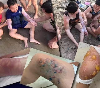 Cảnh báo mùa sứa biển! Cảnh báo mùa sứa biển!