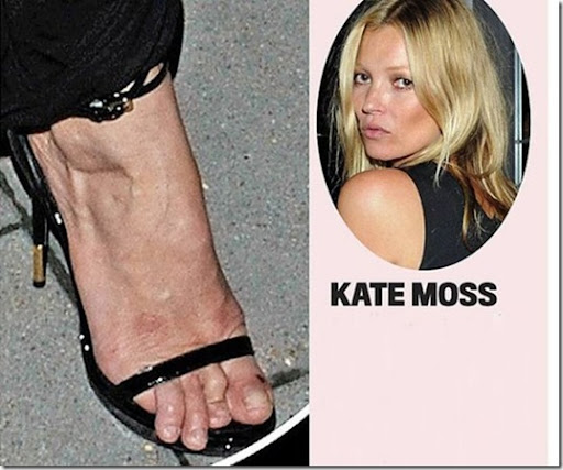 http://lh4.ggpht.com/-OUOKkn4nau4/T8yn4cbWiDI/AAAAAAAB0HQ/zd7pW_mwkOE/celebrity-ugly-feet-fd1525_thumb.jpg